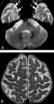 Fig 1.