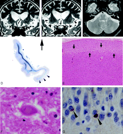 Fig 2.
