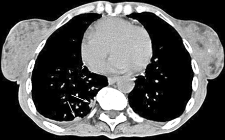 Fig 1.