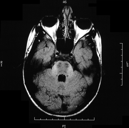 Fig 6.