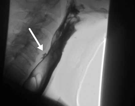 Fig 3.