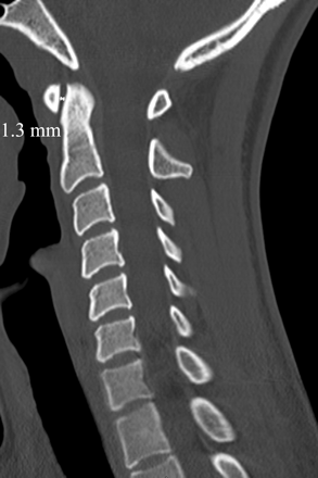 Fig 4.