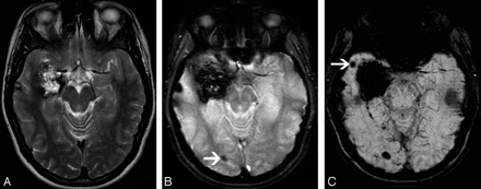 Fig 4.