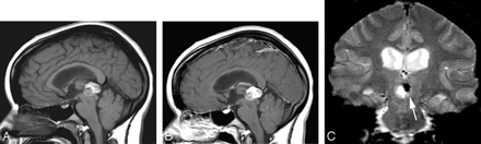 Fig 1.