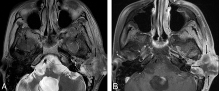 Fig 4.