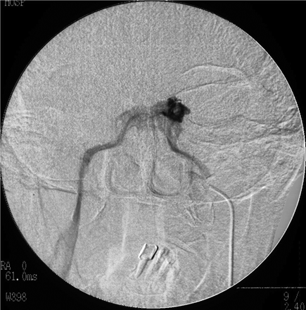 Fig 1.