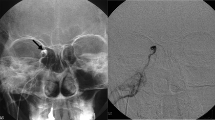 Fig 3.