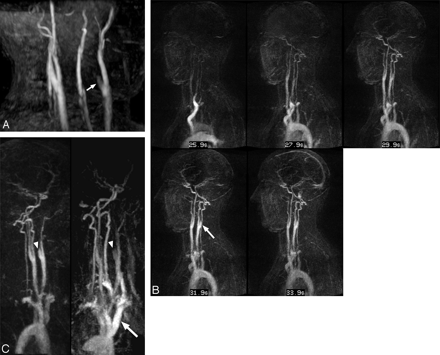 Fig 2.