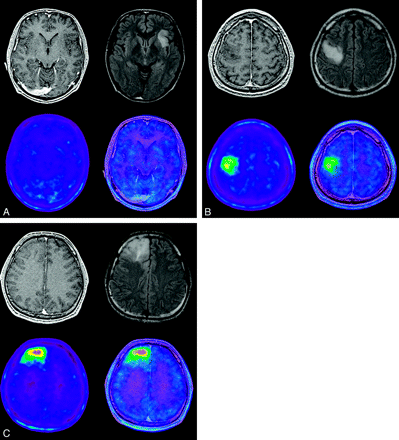 Fig 3.