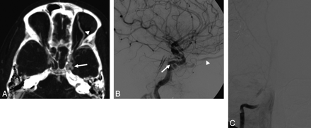 Fig 1.
