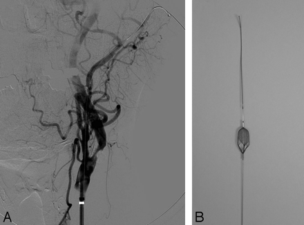 Fig 2.