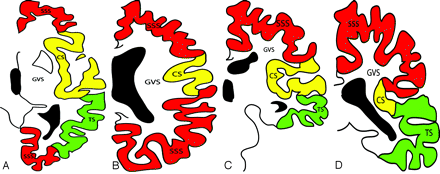 Fig 3.
