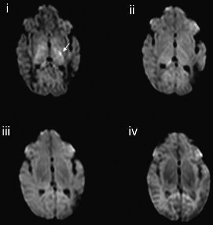 Fig 4.