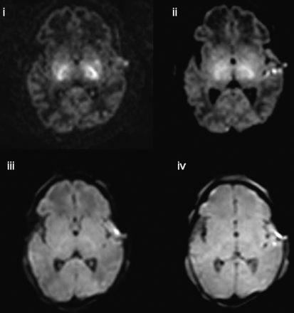 Fig 5.