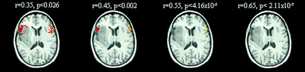 Fig 2.