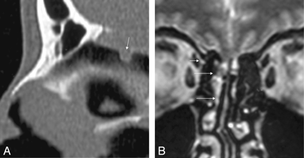 Fig 2.