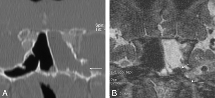 Fig 3.