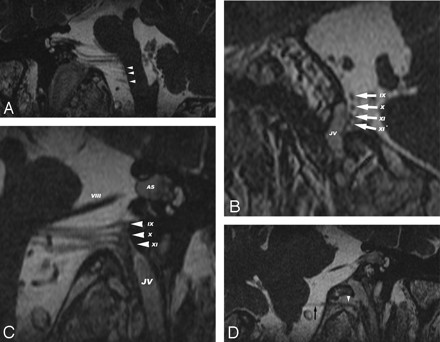 Fig 3.