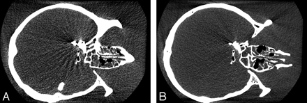 Fig 1.