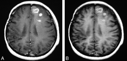 Fig 4.