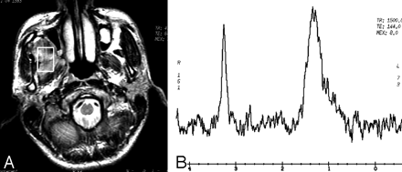 Fig 1.