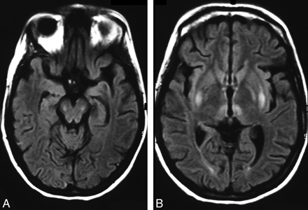   Fig 1. 