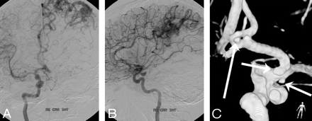 Fig 3.