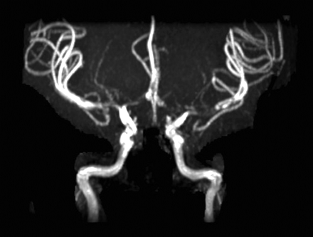  Fig 1. 