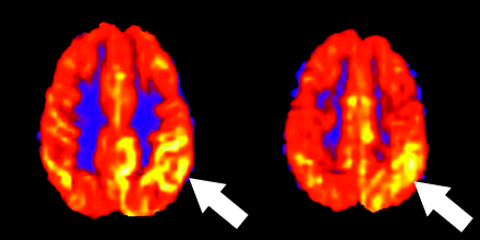 Fig 4.