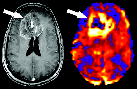 Fig 7.