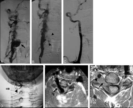 Fig 3.