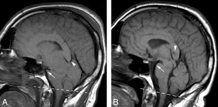 Fig 3.