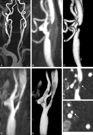 Fig 4.