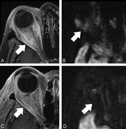 Fig 4.