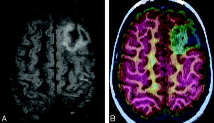 Fig 2.