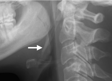 Fig 12.