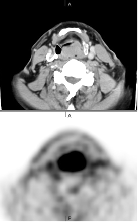 Fig 14.