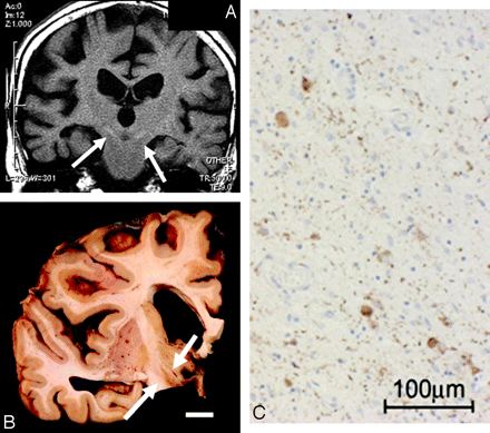 Fig 9.