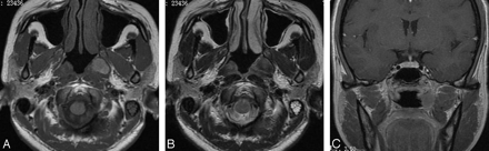 Fig 2.
