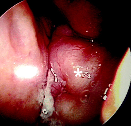 Fig 1.