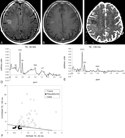 Fig 2.