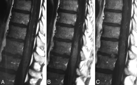 Fig 4.