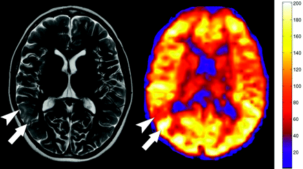 Fig 3.