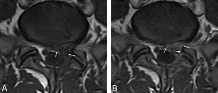 Fig 4.