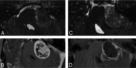 Fig 4.