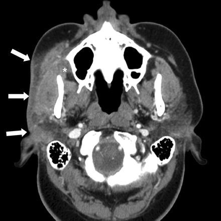 Fig 1.
