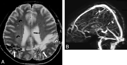 Fig 1.