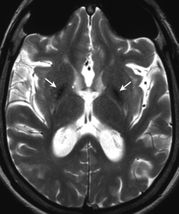 Fig 2.