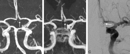 Fig 4.