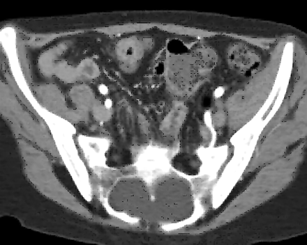 Fig 4.
